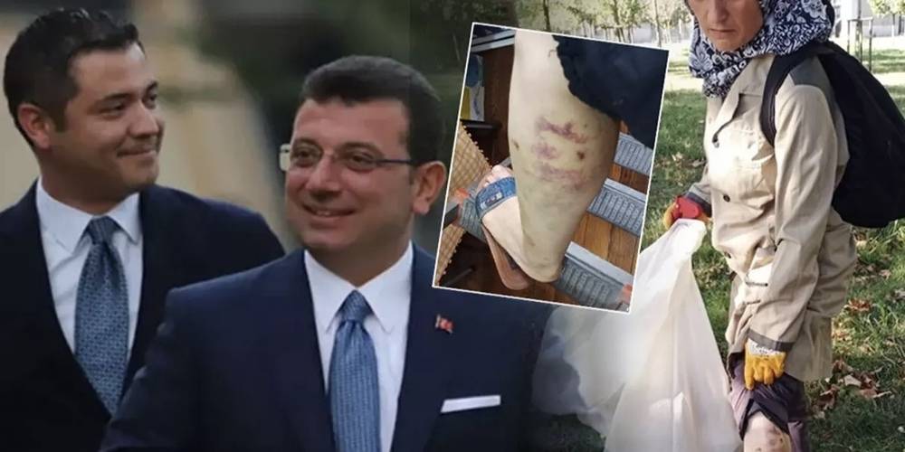 Murat Ongun'un köpeği belediye çalışanını yaraladı! Şikayetçi olan işçi işten kovuldu